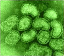 Influenza